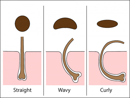 Different shape hair follicles.